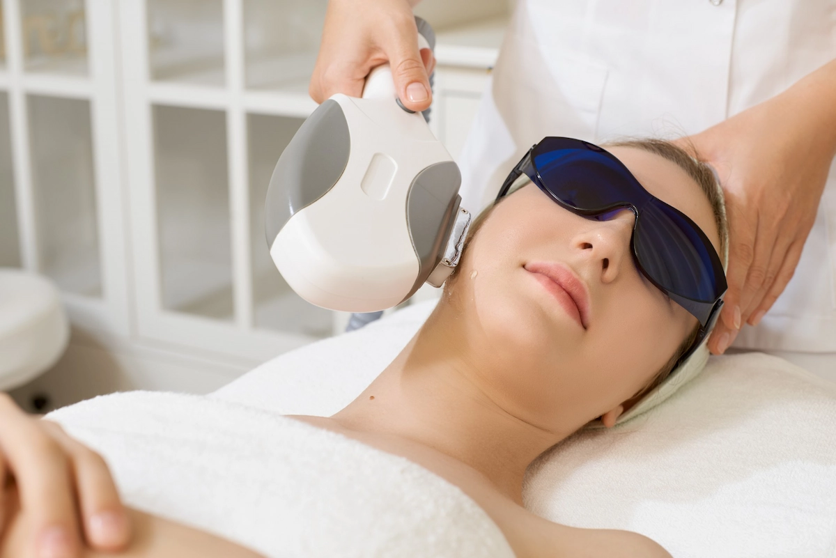 ipl treatment